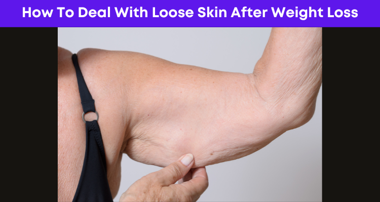How To Deal With Loose Skin After Weight Loss